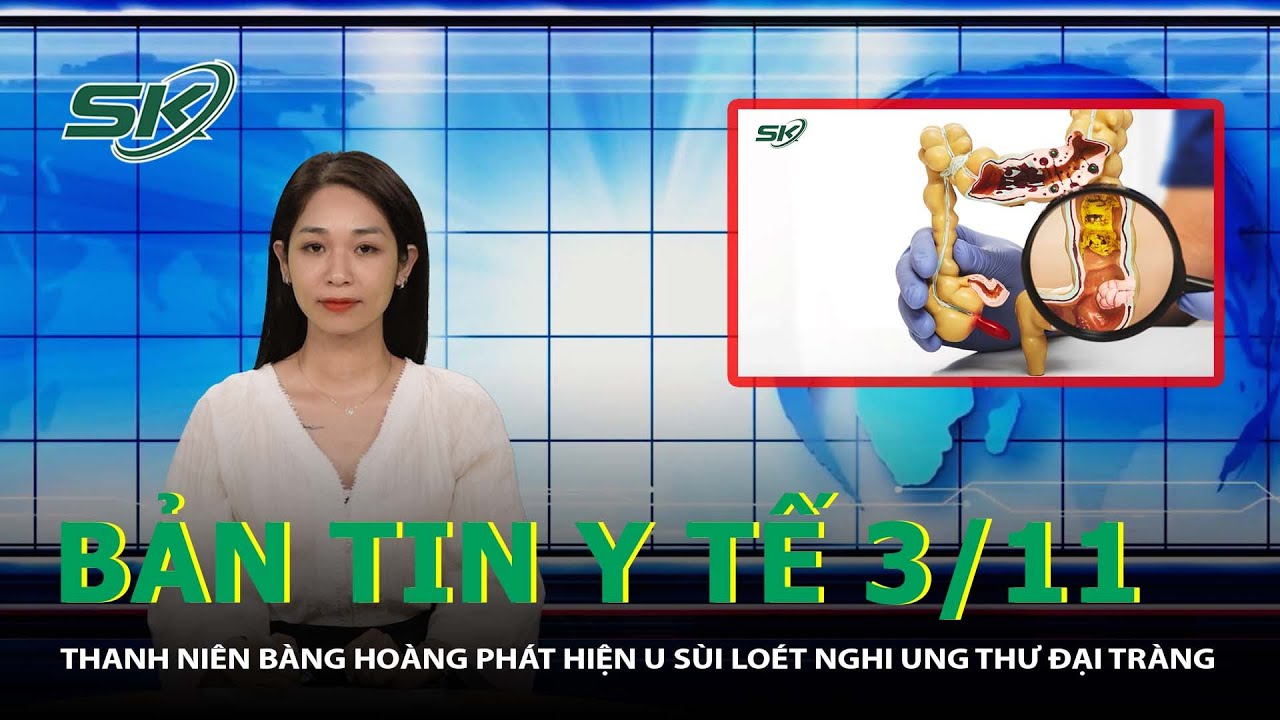 Bản Tin Y Tế 3/11: Thanh Niên Bàng Hoàng Phát Hiện U Sùi Loét Nghi Ung Thư Đại Tràng | SKĐS