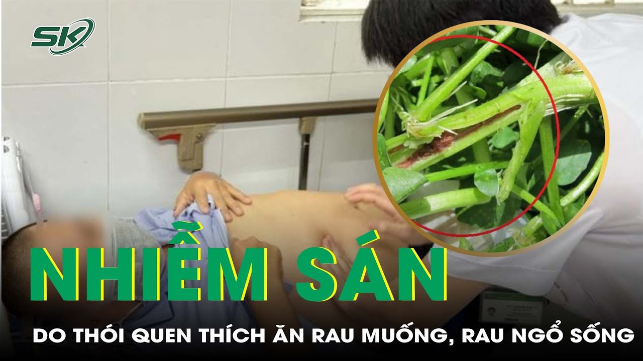 Nhiễm Sán Lá Gan Lớn Do Thói Quen Thích Ăn Rau Muống, Rau Ngổ Sống I SKĐS