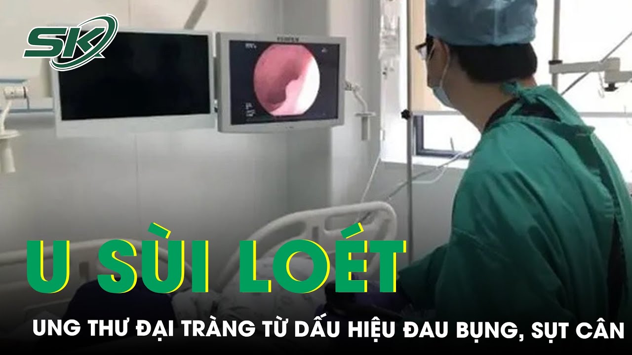 Thường Xuyên Đau Bụng, Rối Loạn Đại Tiện, Nam Thanh Niên Phát Hiện U Sùi Loét Đại Tràng | SKĐS