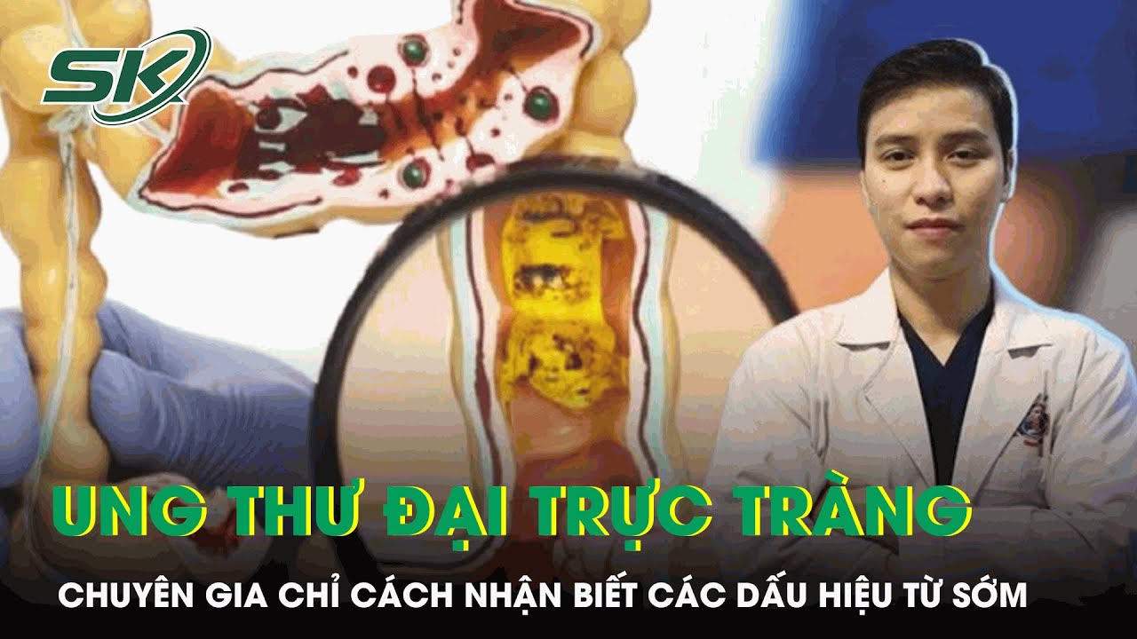 Chuyên Gia Chỉ Cách Nhận Biết Dấu Hiệu Ung Thư Đại Trực Tràng Từ Sớm | SKĐS