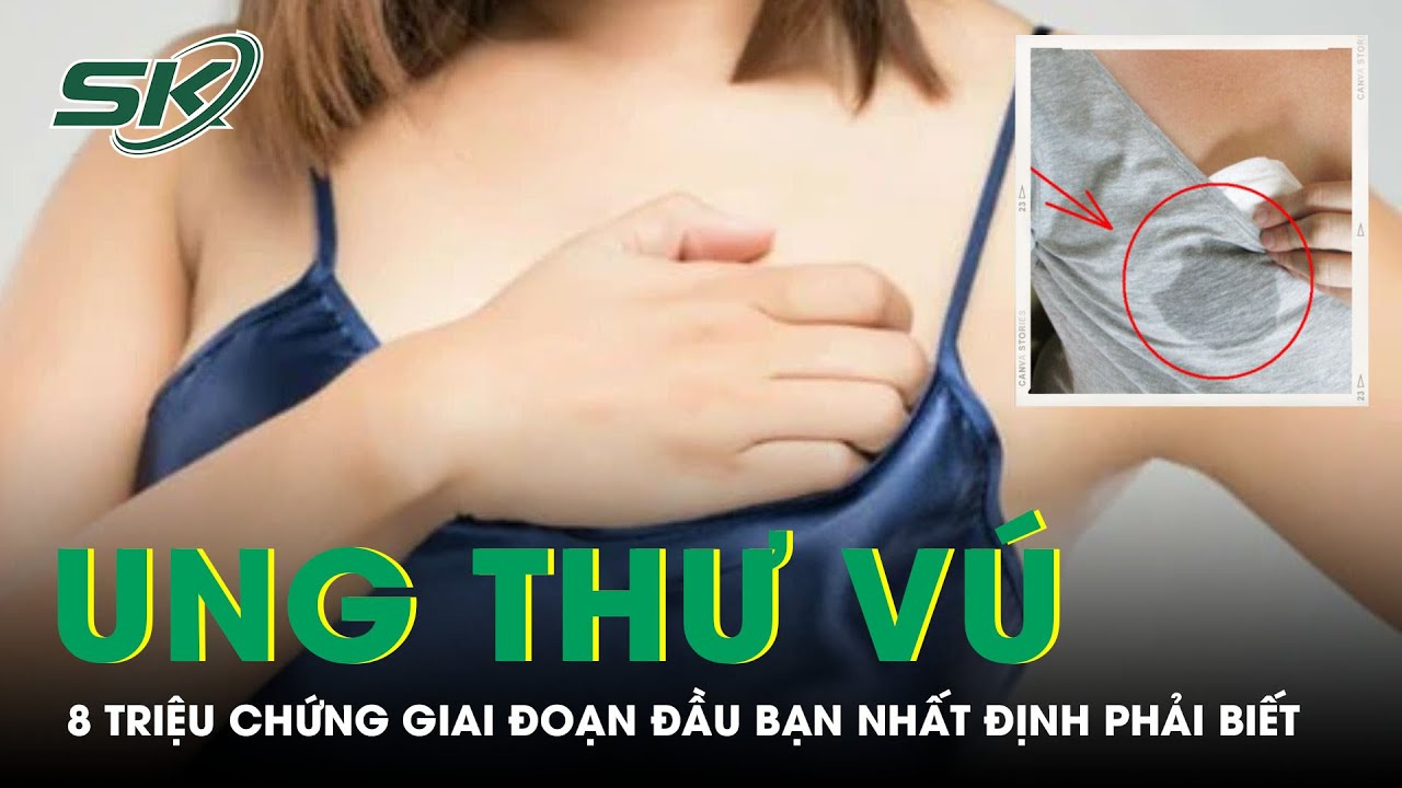 8 Triệu Chứng Ung Thư Vú Giai Đoạn Đầu Bạn Đã Biết? | SKĐS