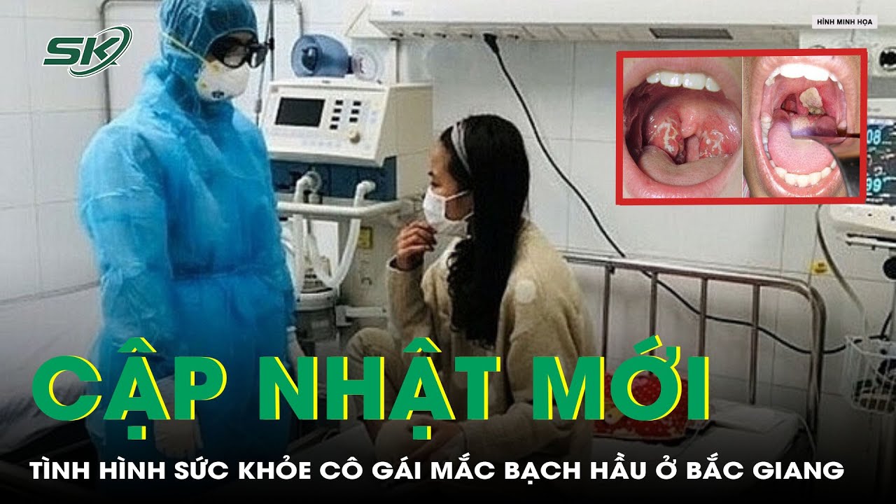 Cập Nhật Tình Hình Sức Khỏe Cô Gái Mắc Bạch Hầu Ở Bắc Giang | SKĐS