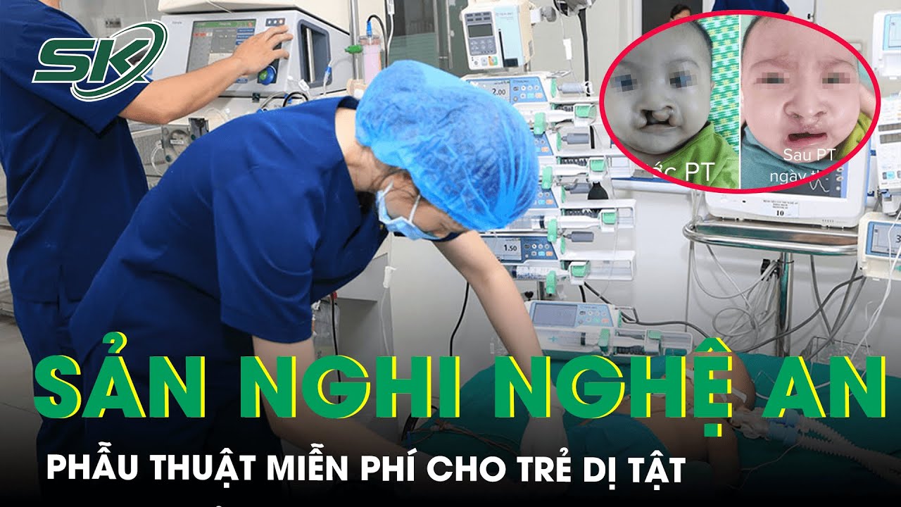 Bệnh Viện Sản Nhi Nghệ An Phẫu Thuật Miễn Phí Cho Trẻ Mắc Dị Tật Khe Hở Môi, Vòm Miệng I SKĐS