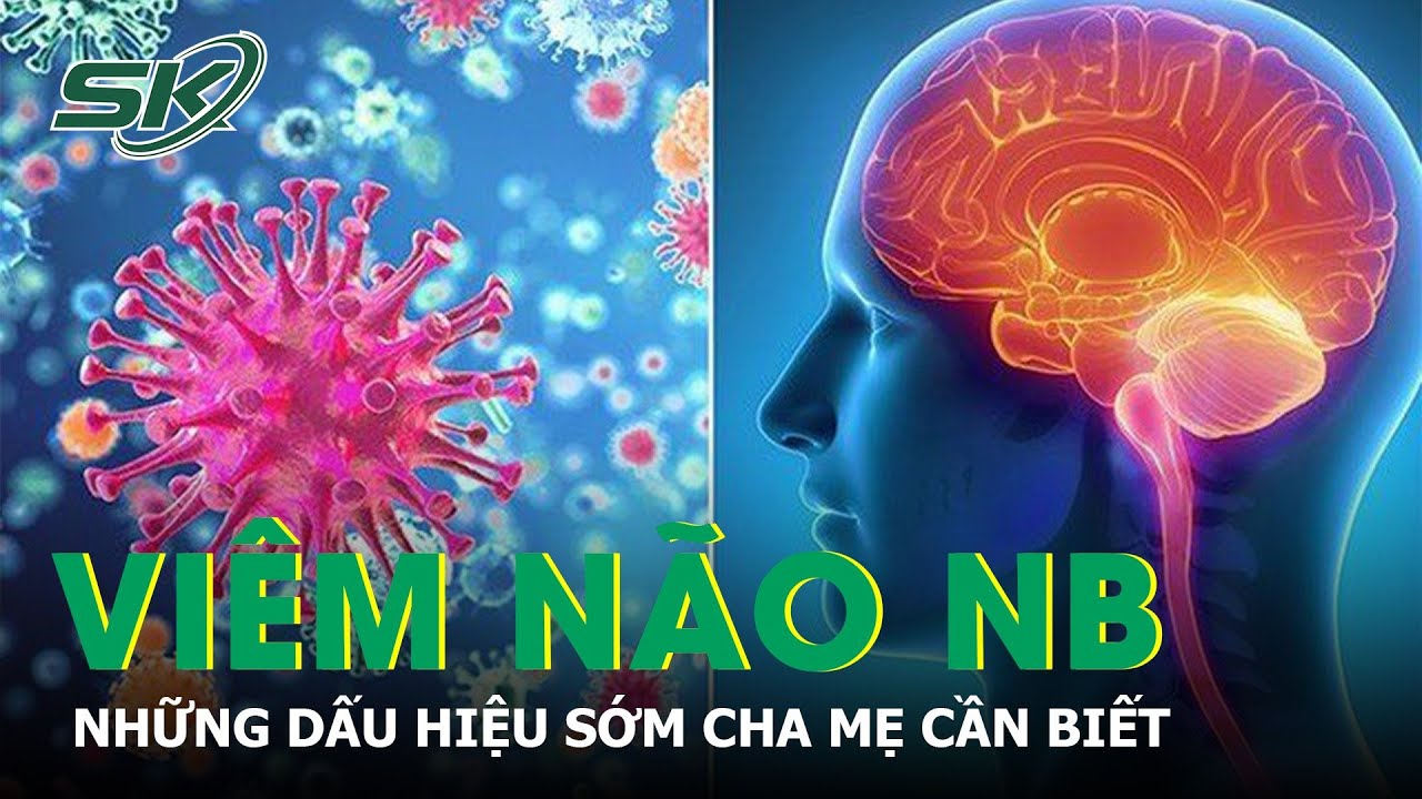 Bé Trai 5 Tuổi Ở Hà Nội Mắc Viêm Não Nhật Bản, Những Dấu Hiệu Sớm Cha Mẹ Cần Biết | SKĐS