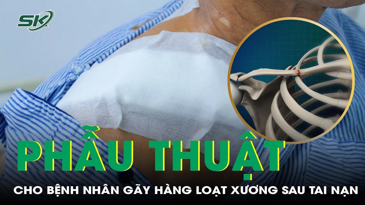 Phẫu Thuật Thành Công Cho Bệnh Nhân Gãy Hàng Loạt Xương Sau Tai Nạn I SKĐS