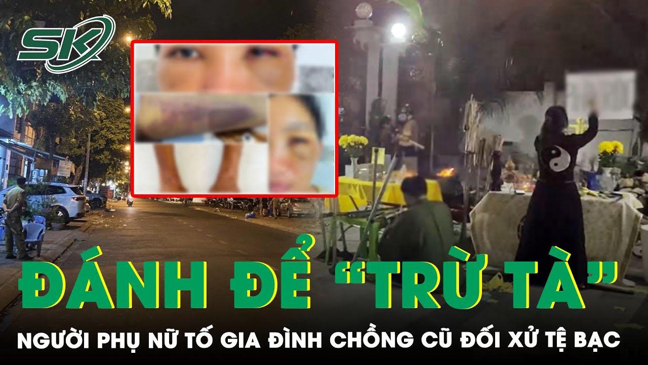 Người Phụ Nữ Tố Bị Gia Đình Chồng Cũ Hành Hung Dã Man Hòng “Trừ Tà”: Nạn Nhân Thương Tật 20% | SKĐS