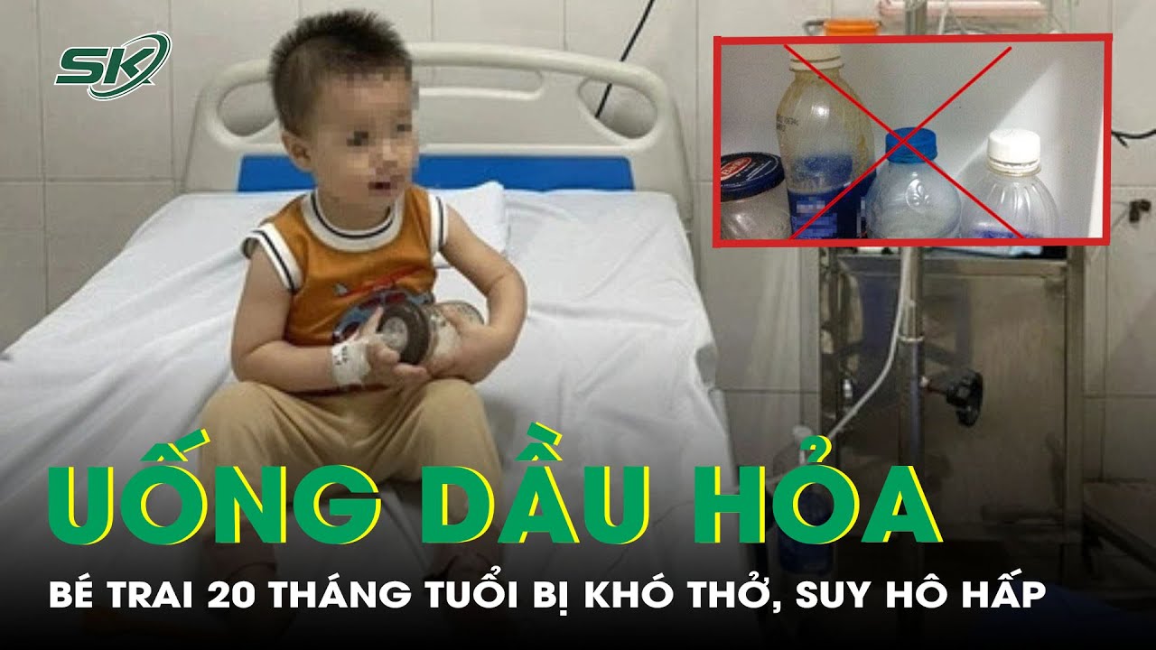 Uống Dầu Hỏa, Bé Trai 20 Tháng Tuổi Bị Khó Thở, Suy Hô Hấp | SKĐS