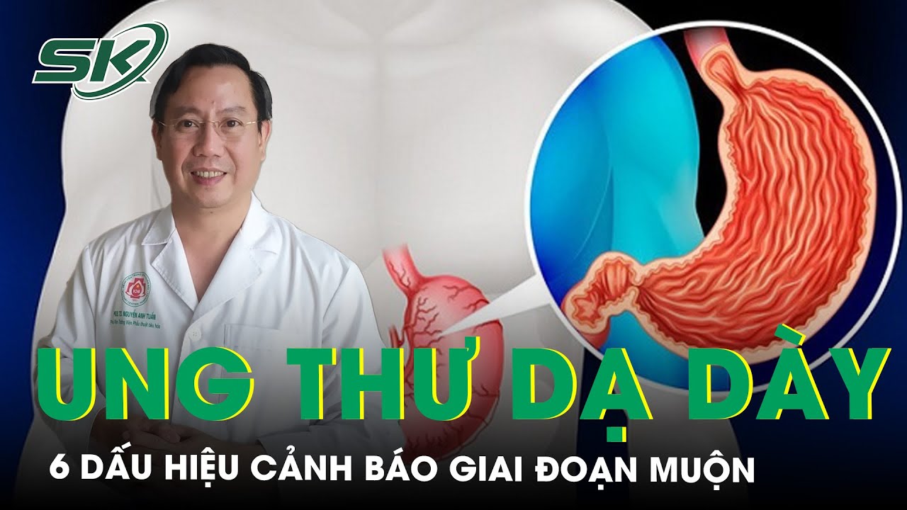 6 dấu hiệu ung thư dạ dày giai đoạn muộn mà bạn cần lưu ý | SKĐS