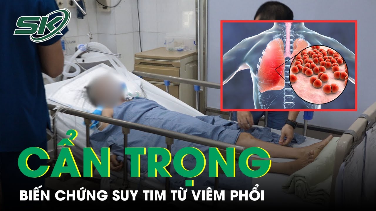 Không chủ quan với bệnh viêm phổi dẫn đến biến chứng suy tim | SKĐS