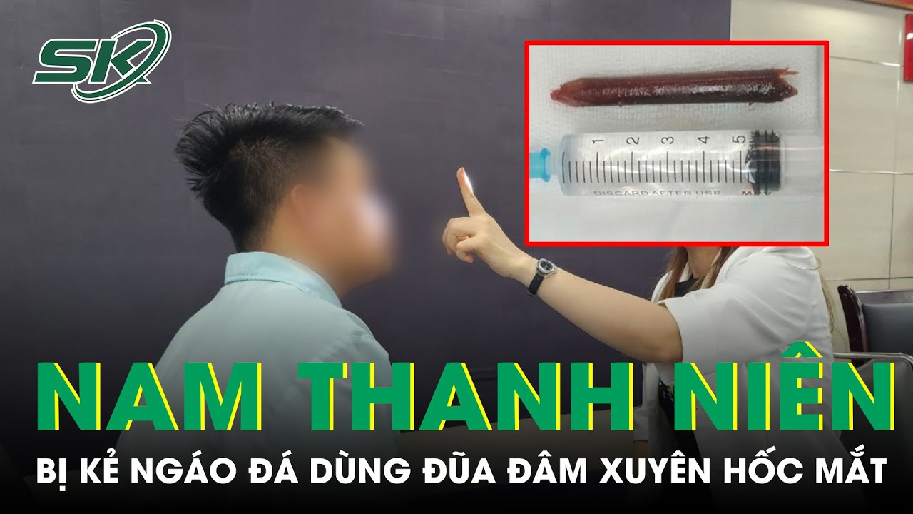 Nam Thanh Niên Bị Kẻ Nghi Ngáo Đá Dùng Đũa Đâm Xuyên Hốc Mắt | SKĐS