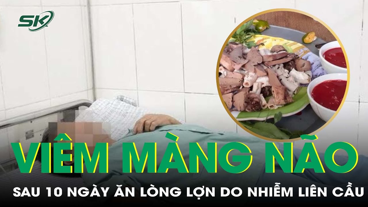 Cấp Cứu Vì Viêm Màng Não Sau 10 Ngày Ăn Lòng Lợn | SKĐS