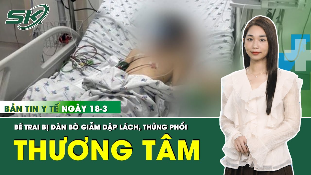 Bản Tin Y Tế 18/3: Bé Trai 10 Tuổi Bị Đàn Bò 20 Con Giẫm Đạp Khiến Nội Tạng Tổn Thương | SKĐS