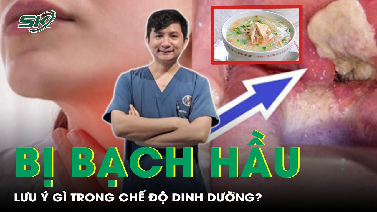 Người bệnh bạch hầu ăn nên và không nên ăn gì để bệnh không nặng thêm? | SKĐS