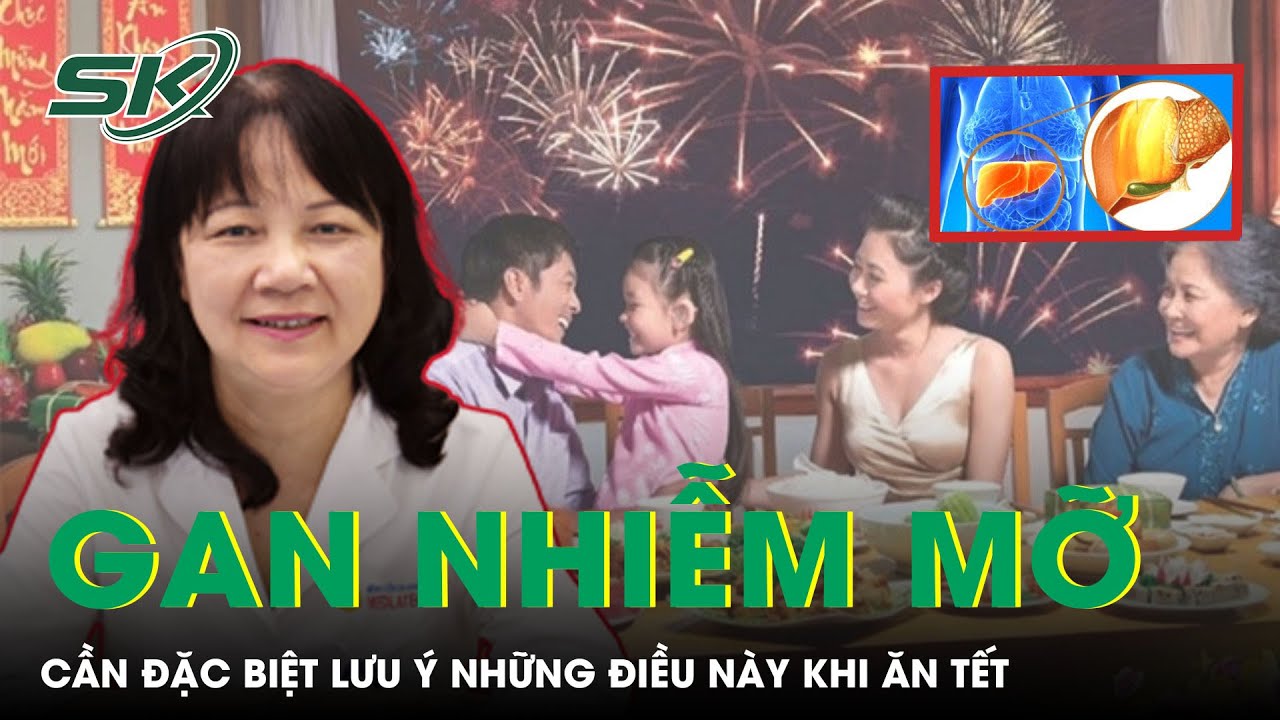 Gan Nhiễm Mỡ Cần Đặc Biệt Lưu Ý Những Điều Này Khi Ăn Tết | SKĐS