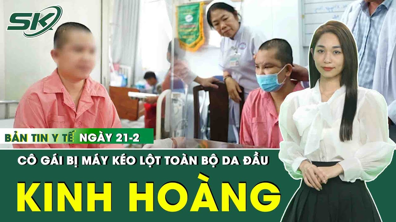 Bản Tin Y Tế 21/2: Kinh Hoàng: Cô Gái Bị Máy Kéo Sợi Lột Toàn Bộ Da Đầu, Lộ Xương Sọ | SKĐS