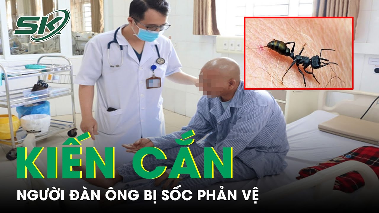 Người Đàn Ông Bị Sốc Phản Vệ Do Kiến Cắn Vào Trán | SKĐS