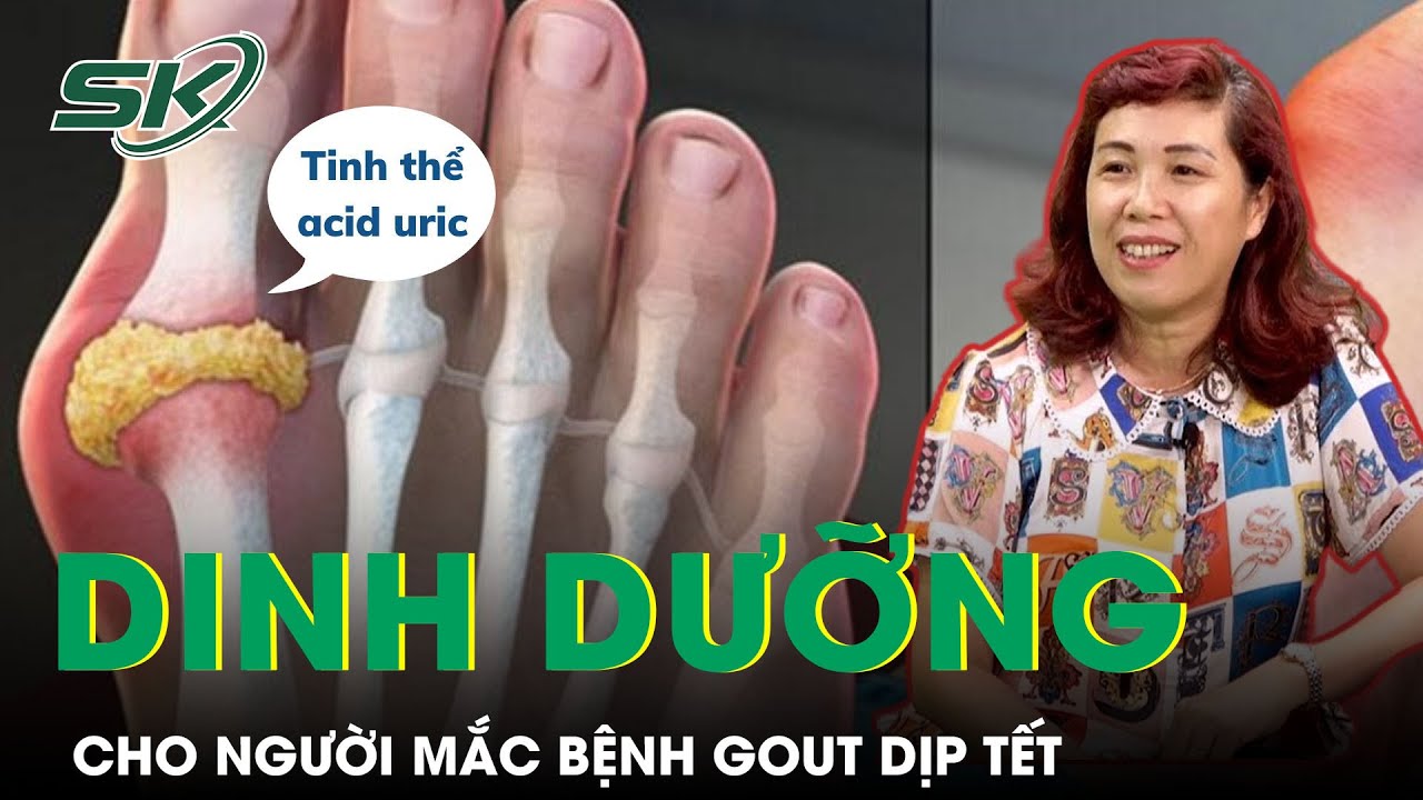 Dinh Dưỡng Cho Người Mắc Bệnh Gout Trong Dịp Tết | SKĐS