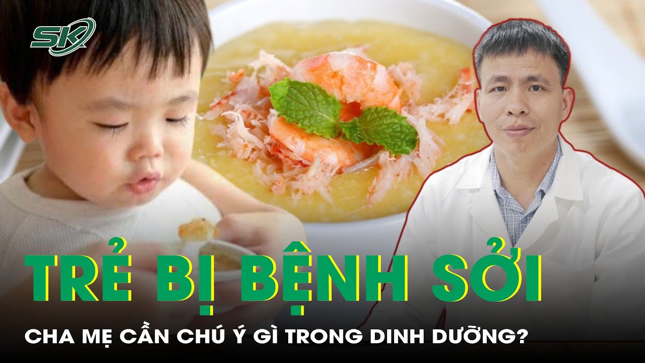 Trẻ bị bệnh sởi, cha mẹ cần chú ý gì trong dinh dưỡng? | SKĐS