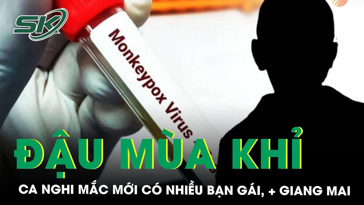 Nam Thanh Niên 17 Tuổi Dương Tính Giang Mai, Nghi Mắc Đậu Mùa Khỉ | SKĐS