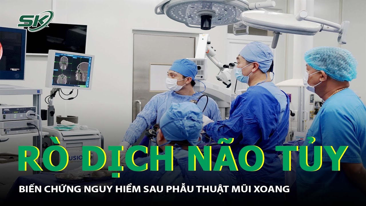 Rò Dịch Não Tủy Qua Đường Mũi: Triệu Chứng Khó Nhận Biết Nhưng Biến Chứng Nghiêm Trọng |SKĐS