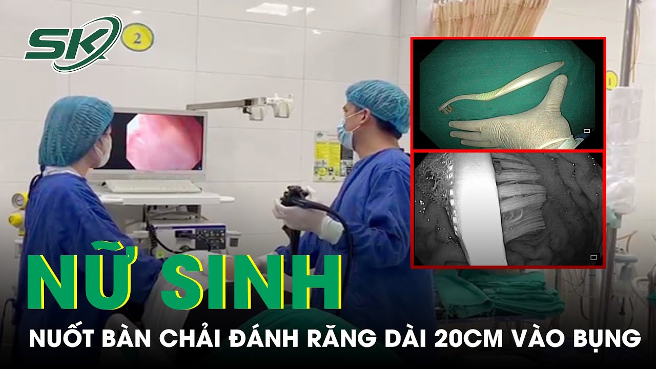 Nữ Sinh Đại Học Nuốt Bàn Chải Đánh Răng Dài 20cm Vào Bụng | SKĐS