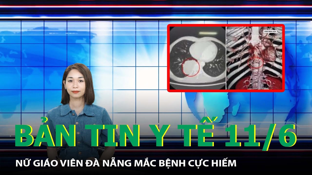 Bản Tin Y Tế 11/6: Nữ Giáo Viên Đà Nẵng Mắc Bệnh Cực Hiếm | SKĐS