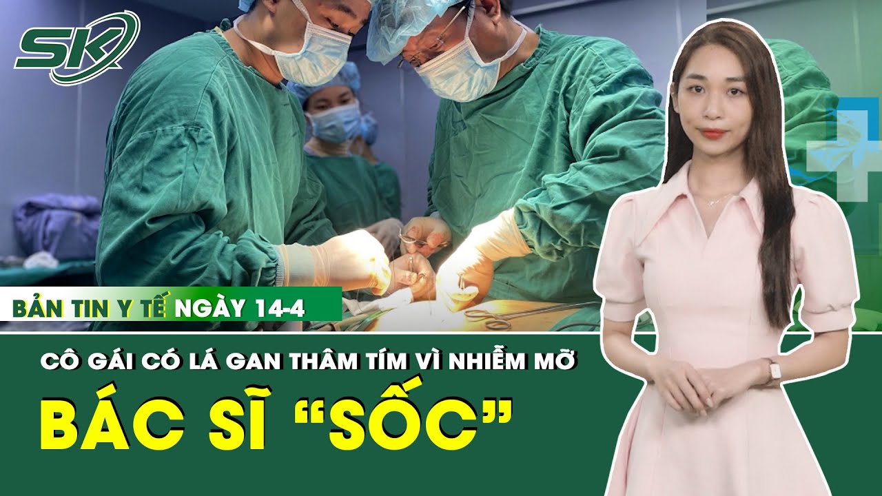 Bản Tin Y Tế 14/4: Cô Gái Có Lá Gan Thâm Tím Vì Nhiễm Mỡ | SKĐS