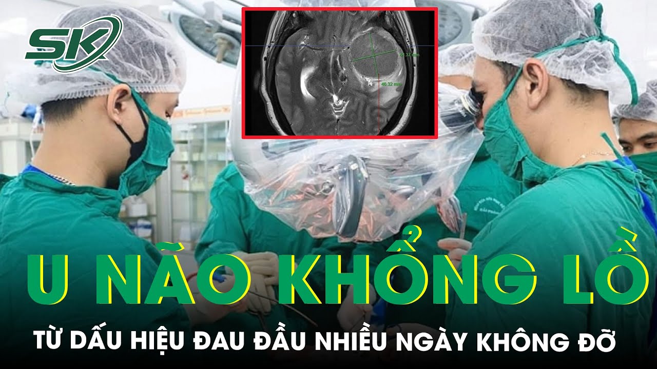 Đau Đầu Nhiều Ngày Không Đỡ, Đi Khám Phát Hiện Khối U Não Khổng Lồ | SKĐS