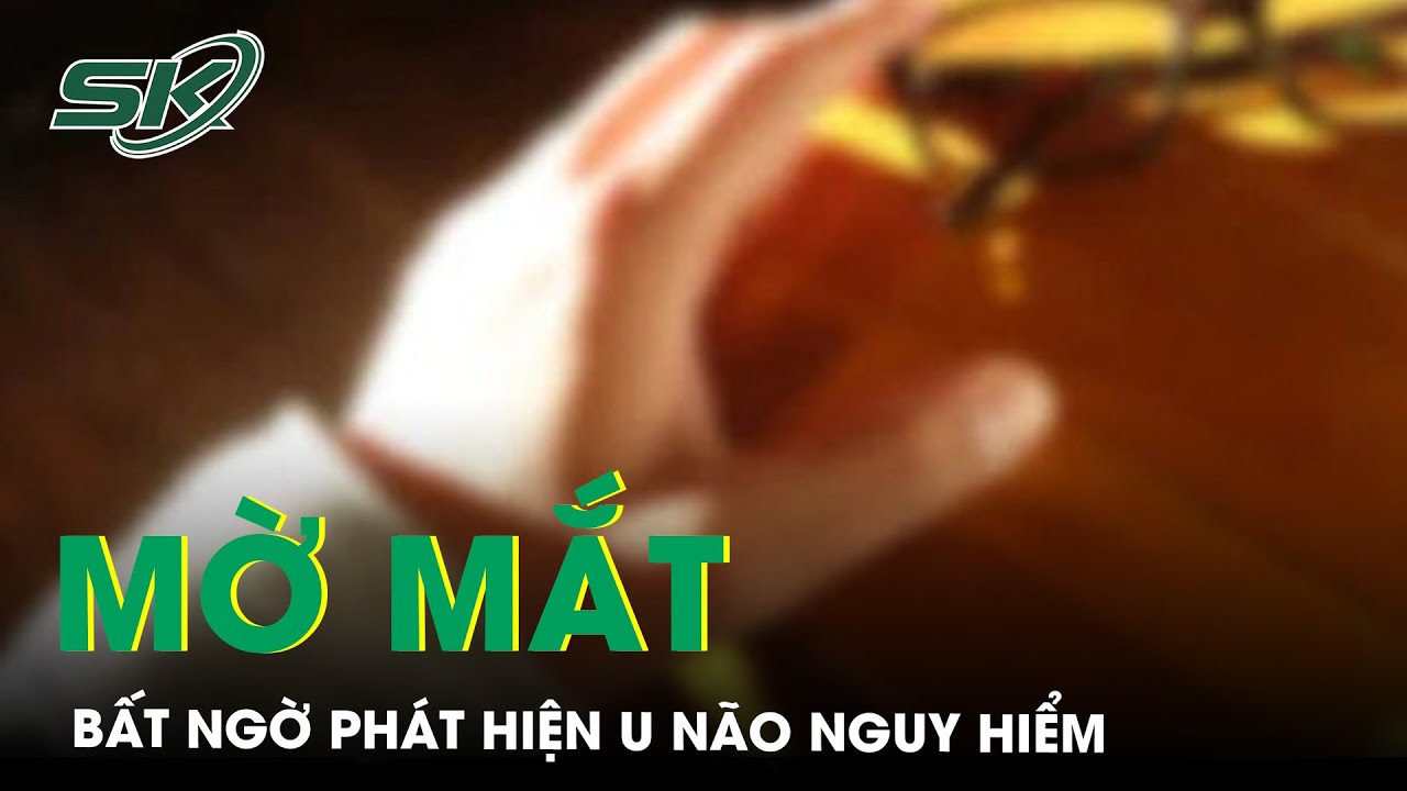 Đau Đầu, Mờ Mắt Tưởng Cận Thị, Bé Gái 9 Tuổi Phát Hiện Mắc U Não Vị Trí Nguy Hiểm | SKĐS