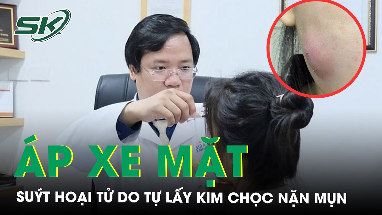 Tự lấy kim chọc mụn rồi dùng tay nặn cô gái trẻ suýt hoại tử mặt | SKĐS