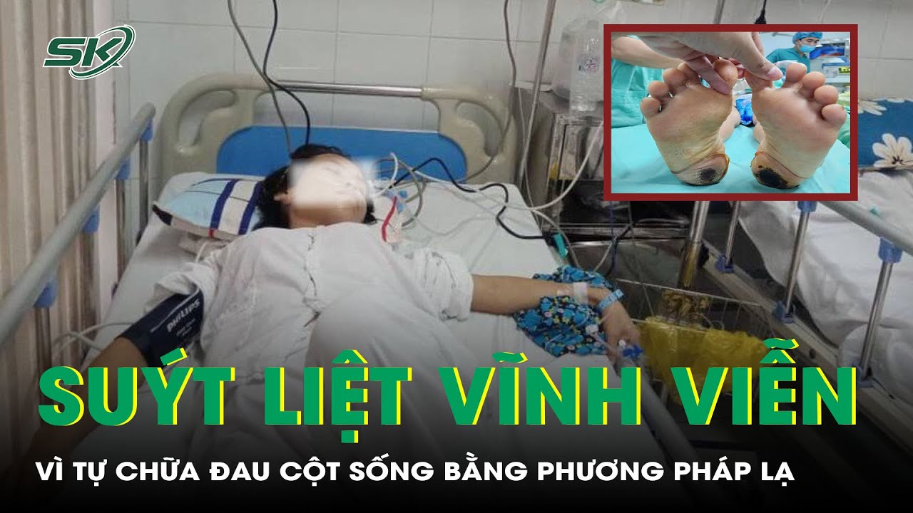 Suýt Liệt Vĩnh Viễn Vì Tự Chữa Đau Cột Sống Bằng Phương Pháp Lạ | SKĐS