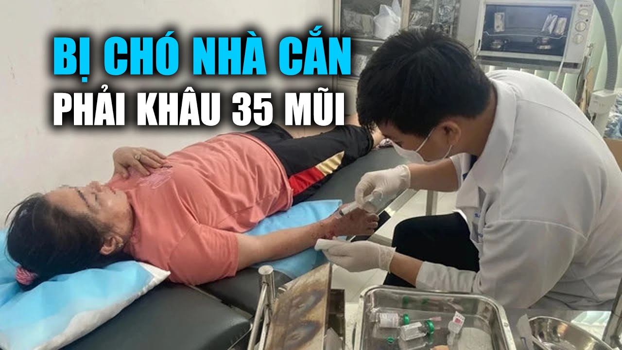 Bị chó nhà cắn, một người phụ nữ phải khâu 35 mũi