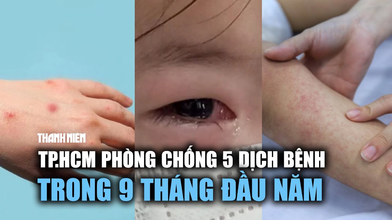 Tình hình dịch bệnh mới nhất tại TP.HCM: 19 ca bệnh đậu mùa khỉ