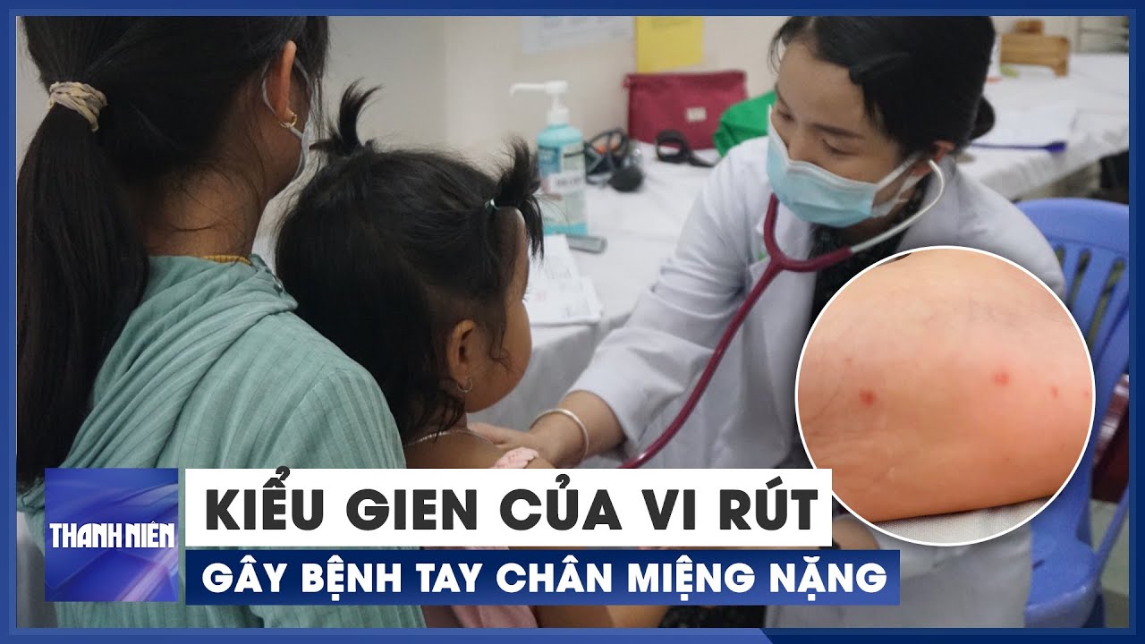 Phát hiện kiểu gien của vi rút gây bệnh tay chân miệng nặng ở TP.HCM