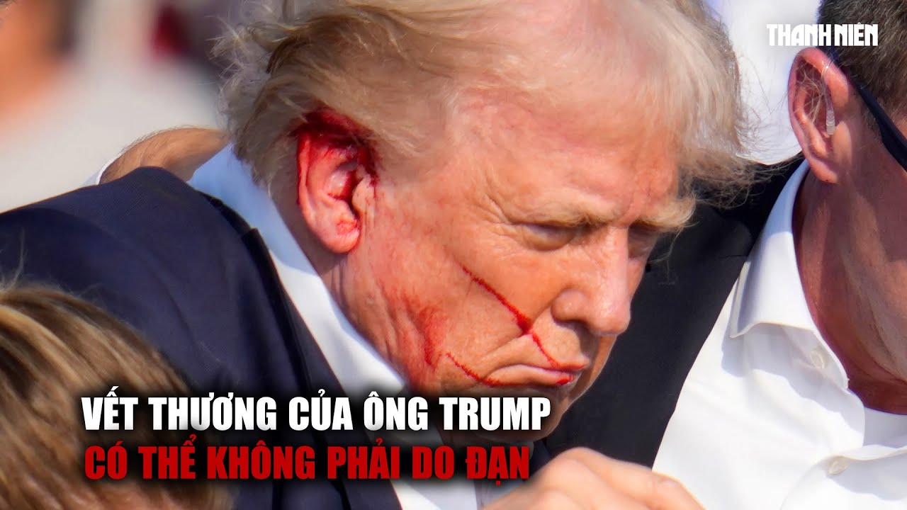 Giám đốc FBI: Vết thương của ông Trump trong vụ ám sát hụt có thể không phải do đạn