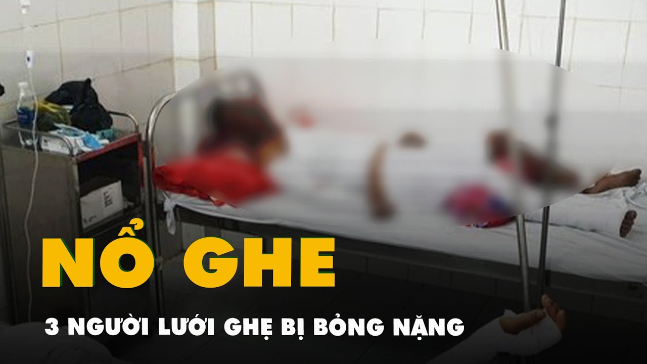 Nổ ghe lưới ghẹ ở Cà Mau, ba người bỏng nặng