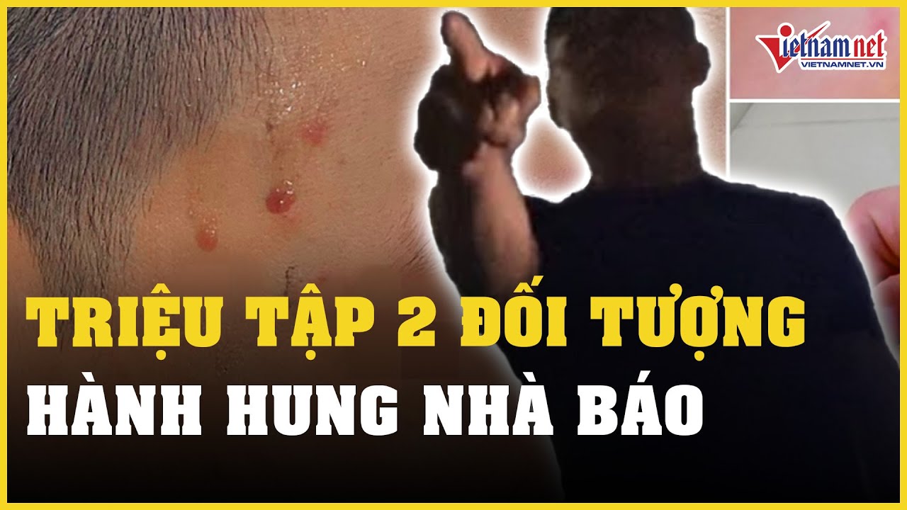 Công an Hà Nội triệu tập 2 đối tượng hành hung nhà báo khi đang tác nghiệp vụ cháy ở Thanh Trì