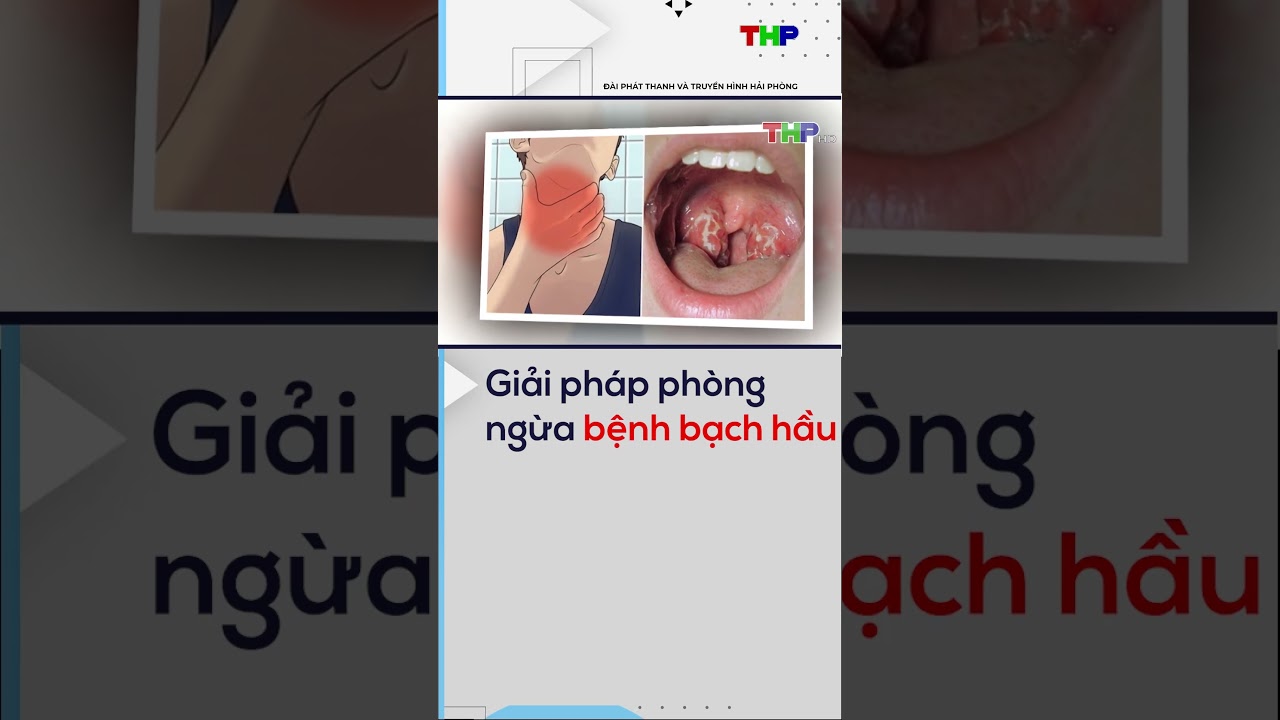 Giải pháp phòng ngừa bệnh bạch hầu