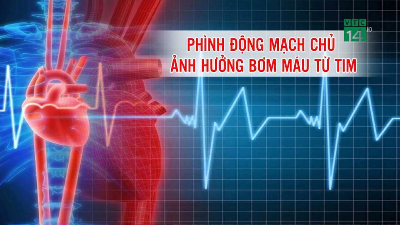 Phình Động Mạch Chủ - ảnh hưởng bơm Máu từ Tim| VTC14