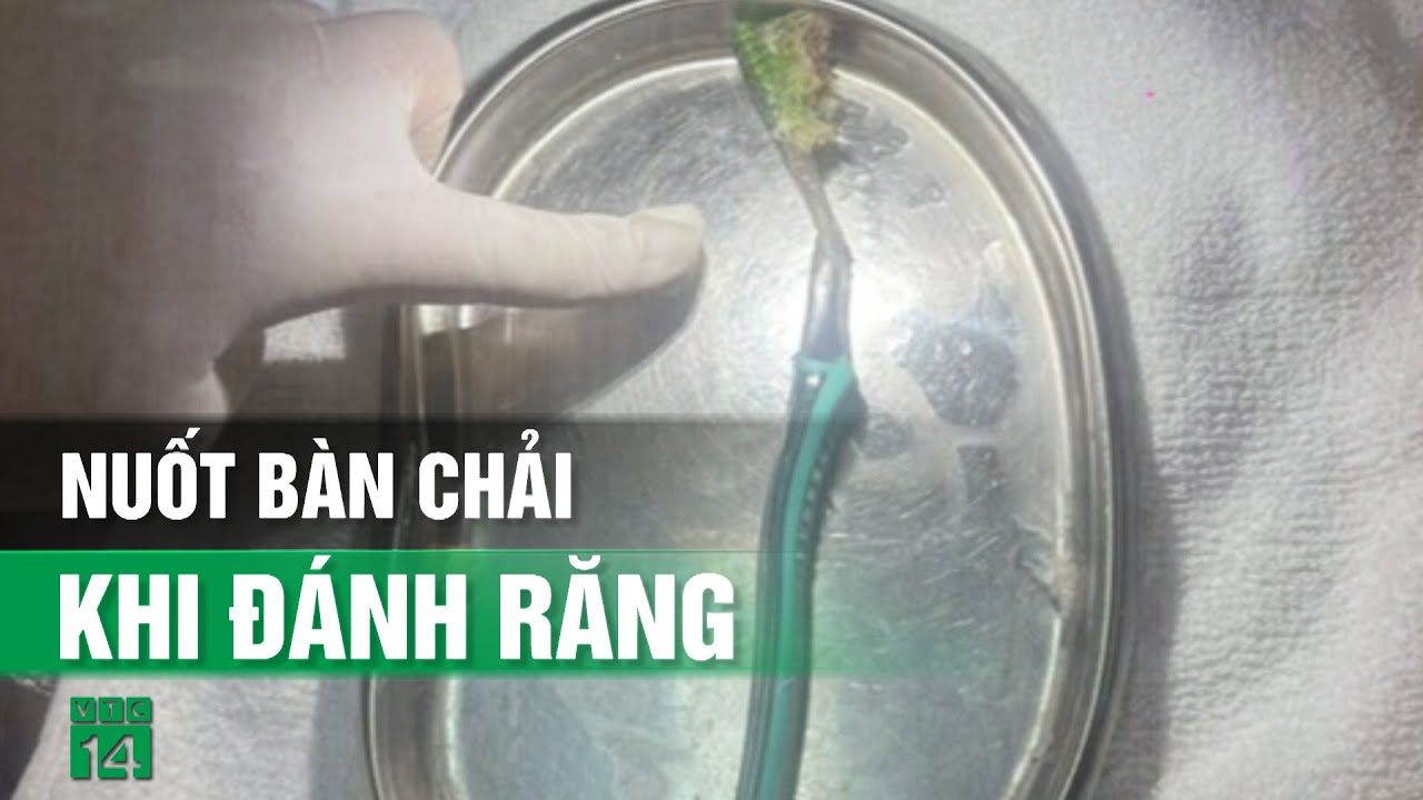 Đau bụng dữ dội vì vô tình nuốt bàn chải vào bụng khi đánh răng| VTC14