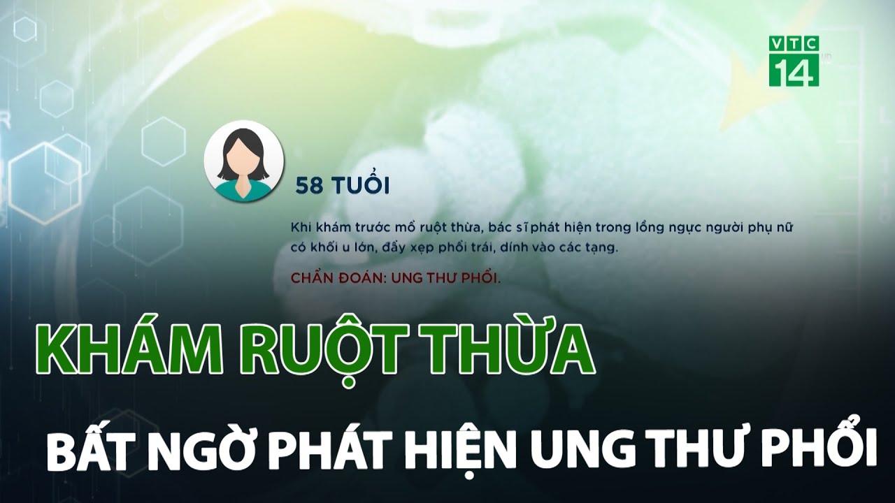 Khám ruột thừa bất ngờ phát hiện ung thư phổi | VTC14