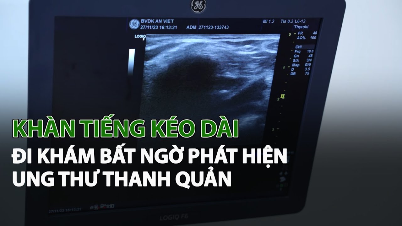 Khàn Tiếng kéo dài, đi khám bất ngờ phát hiện Ung Thư Thanh Quản| VTC14