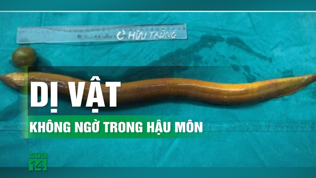 Nam thanh niên suýt mất mạng vì nhét lươn vào hậu môn | VTC14