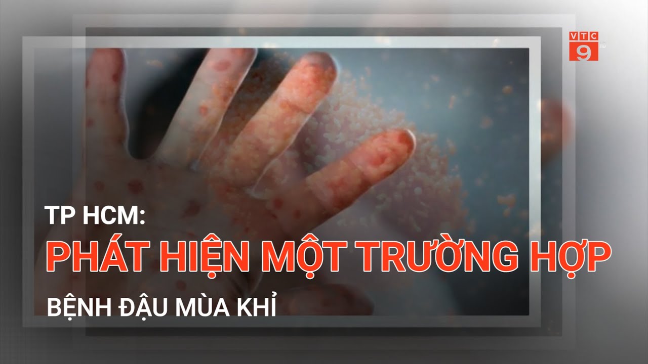 TP HCM: PHÁT HIỆN MỘT TRƯỜNG HỢP BỆNH ĐẬU MÙA KHỈ | VTC9