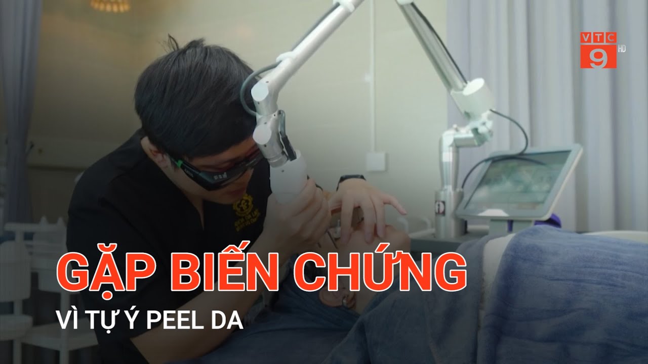 GẶP BIẾN CHỨNG VÌ TỰ Ý PEEL DA | VTC9