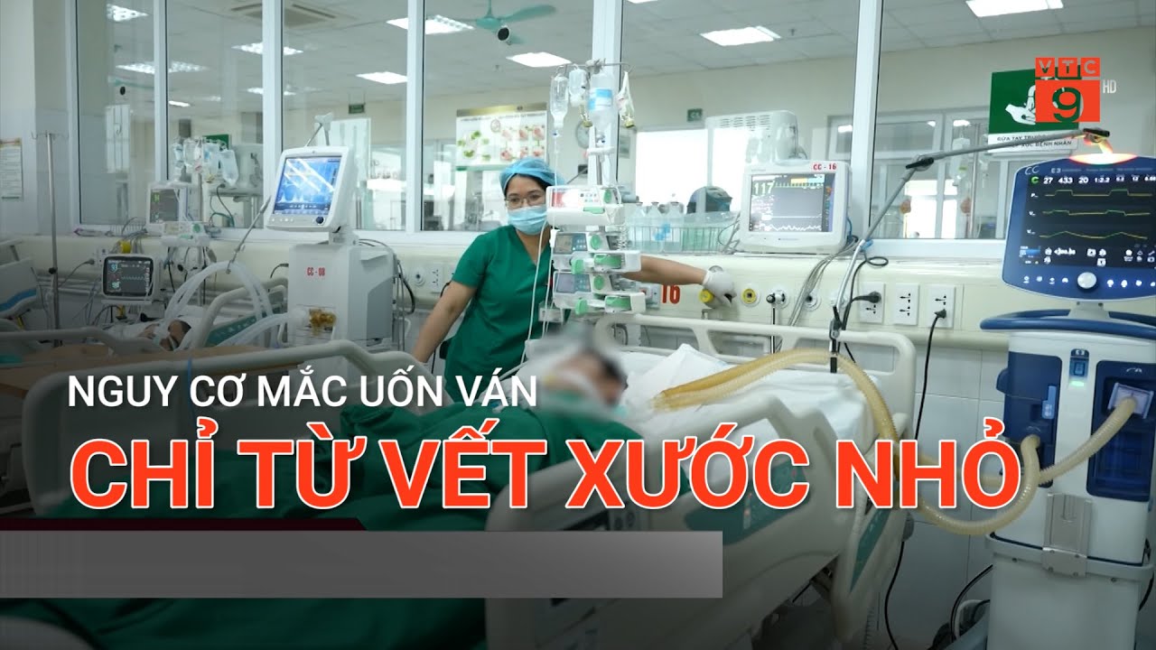 NGUY CƠ MẮC UỐN VÁN CHỈ TỪ VẾT XƯỚC NHỎ  | VTC9