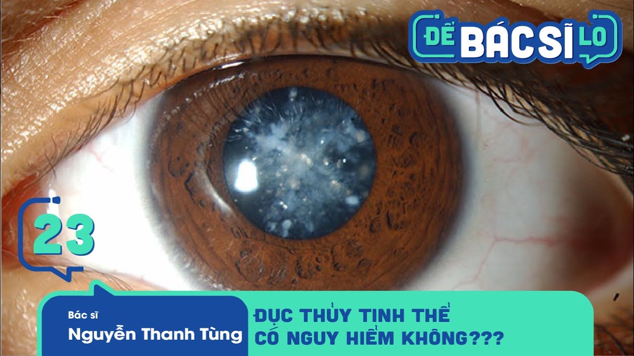 Để Bác Sĩ Lo - Tập 23 | Bệnh Đục Thủy Tinh Thể là nguyên nhân gây ra bệnh 'mù lòa' cần tìm hiểu rõ