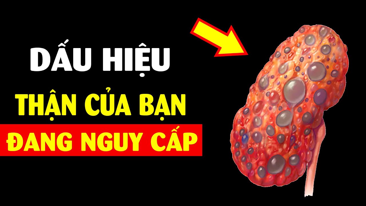 ĐỪNG CHỦ QUAN: 10 dấu hiệu cho thấy bạn bị suy thận