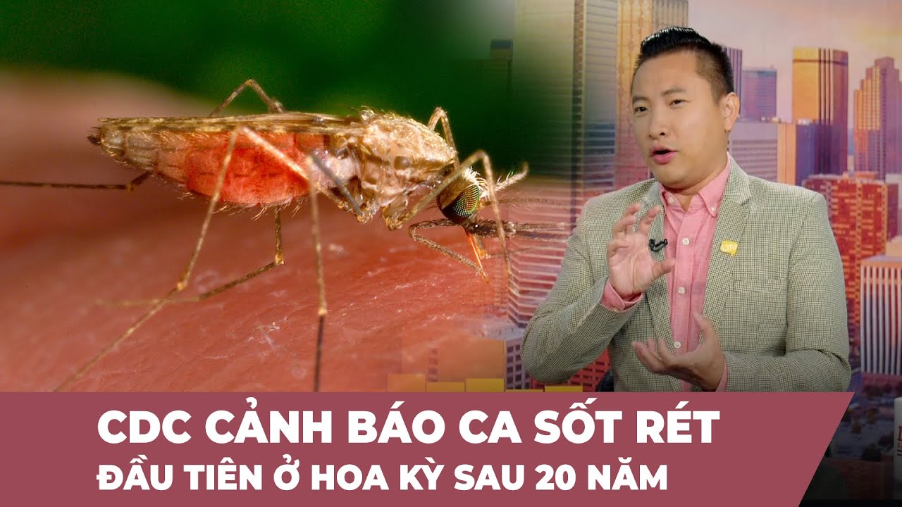 Cà Phê Sáng P4 (06-27-23) CDC cảnh báo ca sốt rét đầu tiên ở Hoa Kỳ sau 20 năm