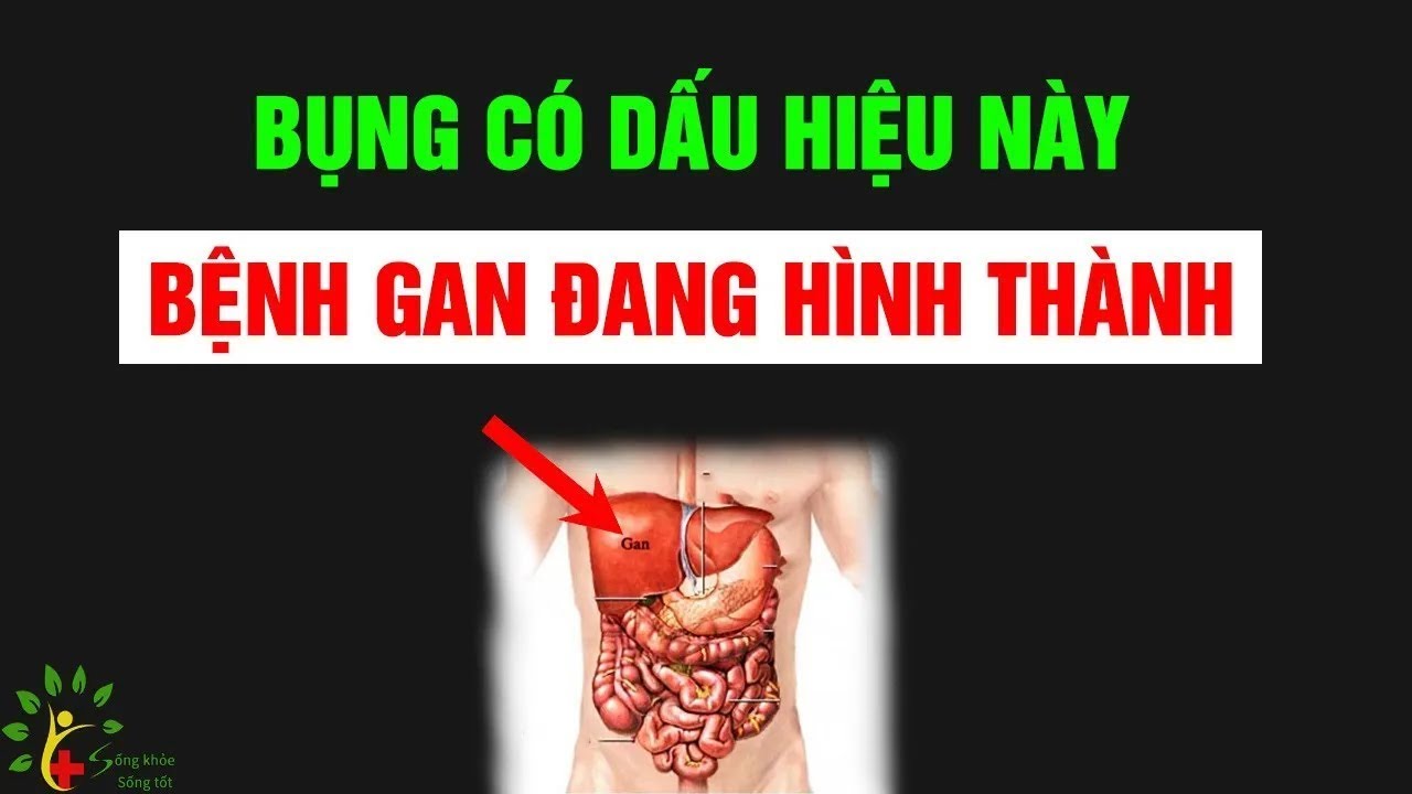 Bụng có dấu hiệu này, bệnh gan đang hình thành